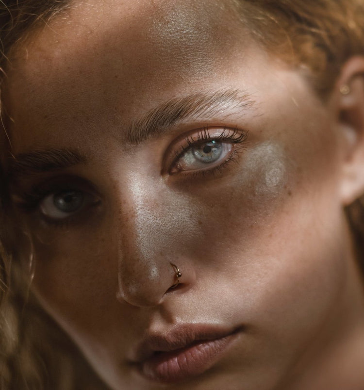 Hyperpigmentation